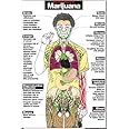 Harmful Effects of Marijuana 24" X 36" Laminated Poster