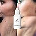 AQISI Permanent Hair Growth Inhibitor Permanent Body Hair Growth Inhibitor Best gift for Women and Men (6Pcs)