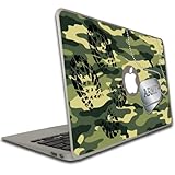 Macbook Pro (15 inch) Vinyl, Removable Skin
