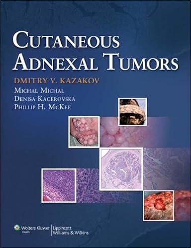 Cutaneous Adnexal Tumors Kindle Edition By Kazakov Dmitry V Mckee Phillip Michal Michal Kacerovska Denise Professional Technical Kindle Ebooks Amazon Com