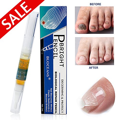 Fungus Stop, Fungal Nail Gel, Anti Fungus Nail Treatment, Effective against nail fungus, Anti fungal Nail Solution, Toenails & Fingernails Solution, Restores Toenail Fungus, Clear, 3 ml