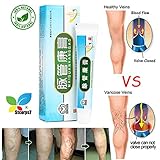 STCorps7 Chinese Medicine Herbal Ointment Varicose Veins Vasculitis Treatment Care Cream