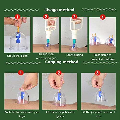 Kangzhu Professional Cupping Therapy Equipment Set Chinese