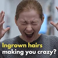 Amazon Com Tend Skin After Shave Solution For Ingrown Hairs