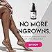Pure Tropix Ingrown Hair Treatment Cream | Razor Bump Cream Skin Treatment | Soothing Cream After Waxing & Shaving | Ingrown Hair Prevention Cream & Ingrown Hair Products | 2 oz (59 ml)