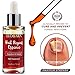 Nail Fungus Repair, Maximum Strength Fungal Toenail Solution, Nail Repair, Restores Healthy Appearance of Discolored & Damaged Nail