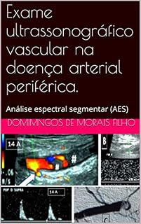 Livro Exame ultrassonográfico vascular na doença arterial periférica.: Análise espectral segmentar (AES)