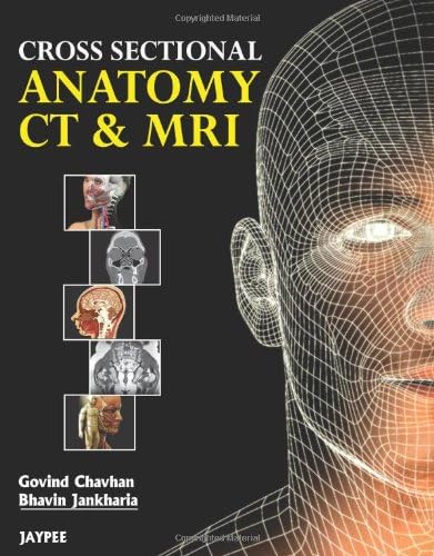 Cross Sectional Anatomy CT & MRI