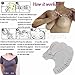 Careonline Adhesive Breast Lift Nipple Covers Bra Boob Bra Uplifting Tape Disposable