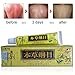 3pcs/Lot High Quality Chinese Herbal Eczema, Psoriasis Creams Dermatitis and Eczema Pruritus Psoriasis CEZUBEM Ointment