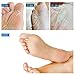 BeaLuz Exfoliating Foot Peel Mask - Exfoliant for Soft Feet in 1-2 Weeks, Peeling Off Calluses & Dead Skin, For Men & Women 2 Pairs