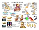 Equine Navicular Syndrome Anatomy Chart