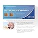 SIlicone Scar Sheets, 4pcs