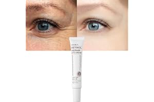 AXNOOCY Magic Retinol Eye Cream for Dark Circles Puffiness and Bags Under Eyes, Instant Results Firm Eye Tightener Anti Aging Under Eye Cream for Men Women, Reduce Fine Lines Wrinkles and Age Spots, 1 Oz