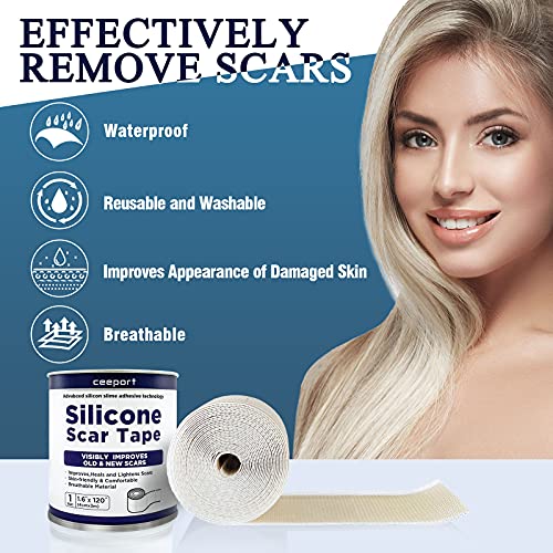 Silicone Scar Tape for Scar Away(1.6"x120"),Highly Comfortable and