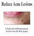 I Max Peptides, Stem Cell & Arbutin Lightening Cream to Lighten, Even Skin Tone, Visibly Diminish Age Spots, Erase Melasma on Ethnic Skin and Reduce Acne Lesions