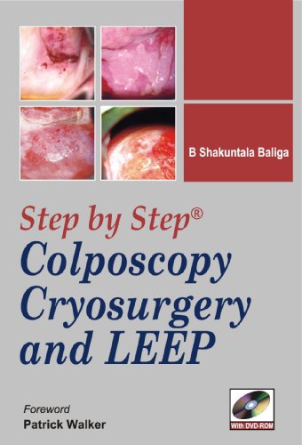 STEP-BY-STEP COLPOSCOPY, CRYOSURGERY AND LEEP