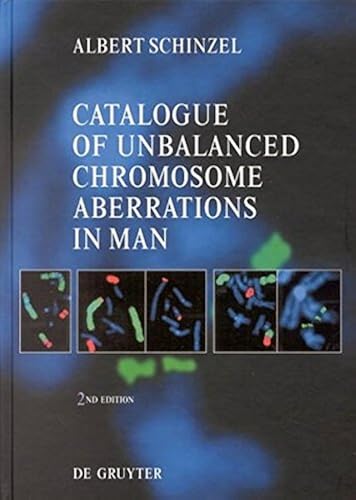 Download Catalogue of Unbalanced Chromosome Aberrations in Man PDF
