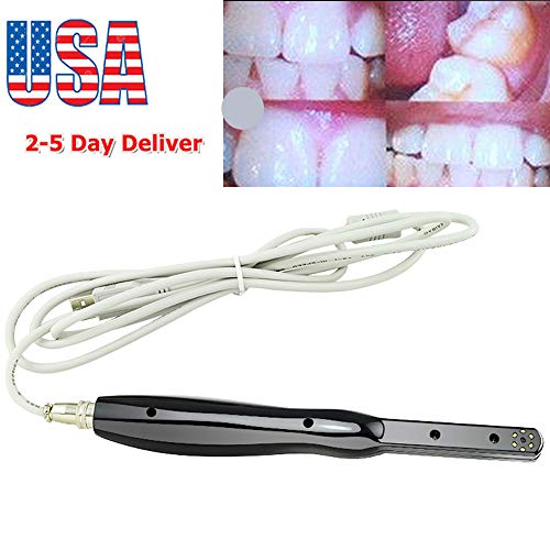 Best Dental Intraoral Cameras Buying Guide GistGear