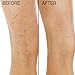 PH Factor 5.5 Anti-Aging Varicose Vein and Spider Vein Cream with Vitamin K, Arnica, Coconut Oil. Flawless leg cream comes in large 10oz (296 mL) bottle with pump.
