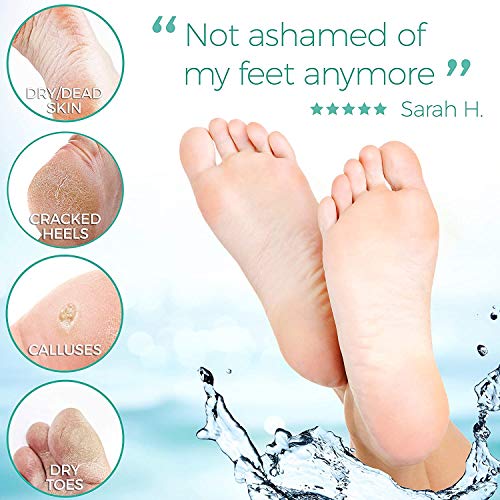 Jasmine Foot Peel Mask For Cracked Heels, Dead Skin and Calluses Make Your Feet Baby Soft