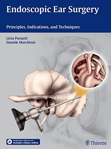 B.E.S.T Endoscopic Ear Surgery: Principles, Indications, and Techniques [T.X.T]