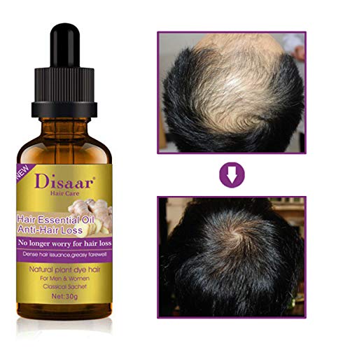 Avashine Natural Hair Growth Serum, Ginger Essential Oil, Hair Growth oil, Anti Hair Loss Essence, Hair Thinning Treatment, Healthy Strong Thick Hair, Treats Baldness Weak Brittle Thinning Hair