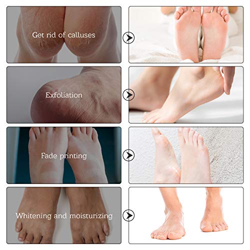Aliver Foot Peel Mask (5 Pack) for Cracked Heels That Remove Dead