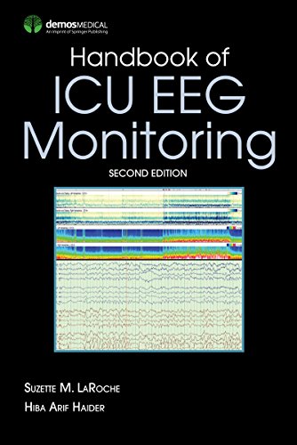 Handbook of ICU EEG Monitoring - //medicalbooks.filipinodoctors.org