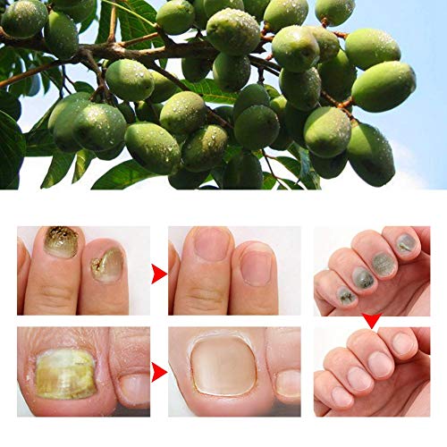 Nail Repair Cream, 20ML Nail Cream Repair, Nail Strengthener, Finger Toe Nail Care Cream for Men and Women Home Use