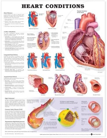 Heart Conditions