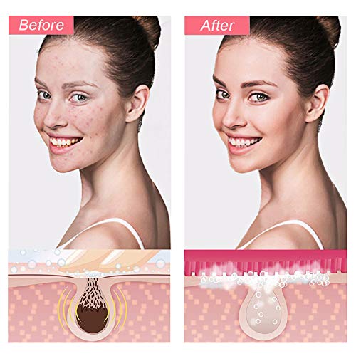 VIVK Sonic Facial Cleansing Brush - Rechargeable Electric Waterproof Silicone Exfoliating Face Scrub Brush(Pink)