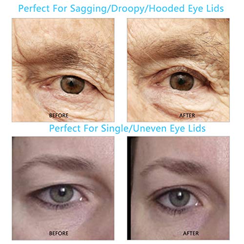 3D Lace Eye Lids Lift Stickers, Natural Invisible Slim One-sided Double Eyelid Tapes, Medical Fibre, Instantly Eyelids Lift Without Surgery, Perfect for Uneven/Single/Droopy/Hooded/Sagging Eyelids