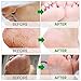 Exfoliating Foot Peel Mask for Smooth Soft Touch Feet – 2 Pairs per Box – Peeling away Calluses and Dead Skin Remover. Repair Rough Heels 2 packs – Baby Foot Gel Socks Booties – Natural Aloe Extractthumb 4