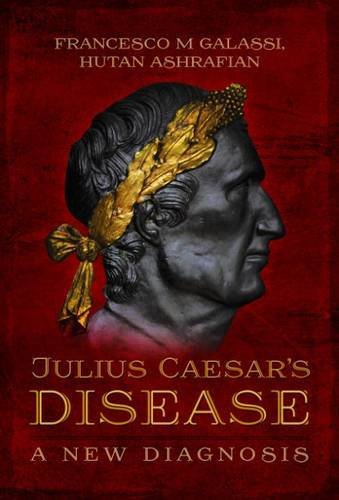 Julius Caesar's Disease: A New Diagnosis by Francesco Maria Galassi, Hutan Ashrafian