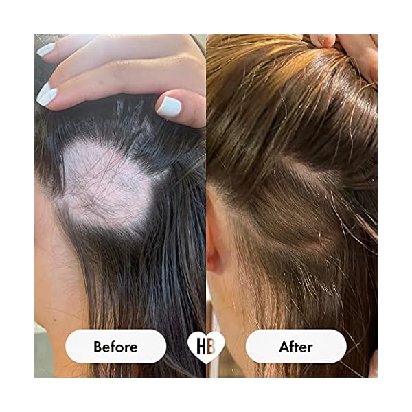 Chewable-Hair-Vitamins-for-Hair-Growth-Anti-Hair-Loss-Thinning-Hair-Multivitamins-Skin-Nails-Hair-Supplements-for-Women-Biotin-Hair-Regrowth-Pills-60-Chewy-Gummy-Tablets-1-Month-Hairburst Hair Burst Vitamin Hair Gummies with Biotin for Longer & Thicker Looking Hair - Added Zinc, Vitamin C & Selenium - 1…