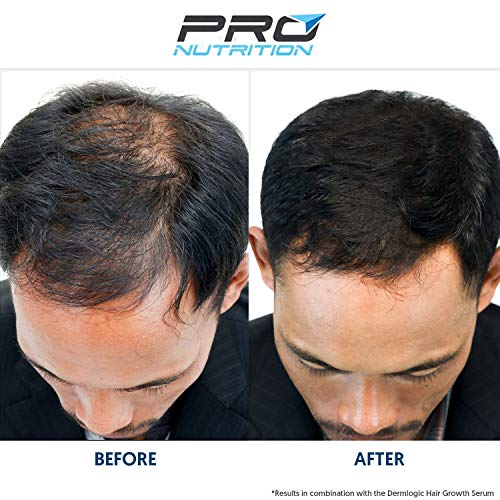 Shopus Biotin Hair Growth Vitamin Supplement Grow Fuller