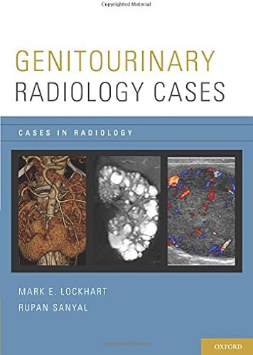 Download Genitourinary Radiology Cases (Cases in Radiology) PDF