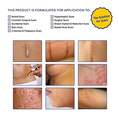 Aroamas Professional Silicone C-Section Scar Removal Sheets, Soft Adhesive Fabric Strips, Drug-Free, Relieves Itching, Remove Keloid Scars, Acne (2 Month Supply)