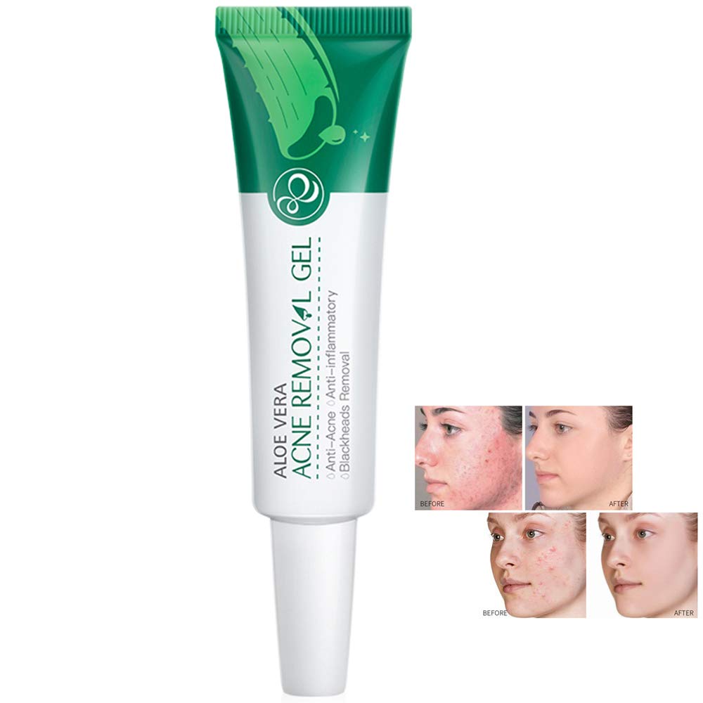 serum pore minimizer