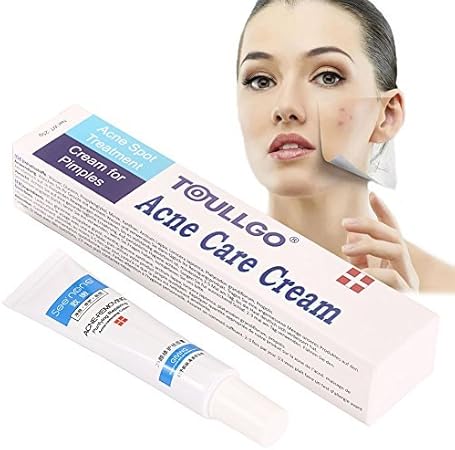 topical cream for cystic acne