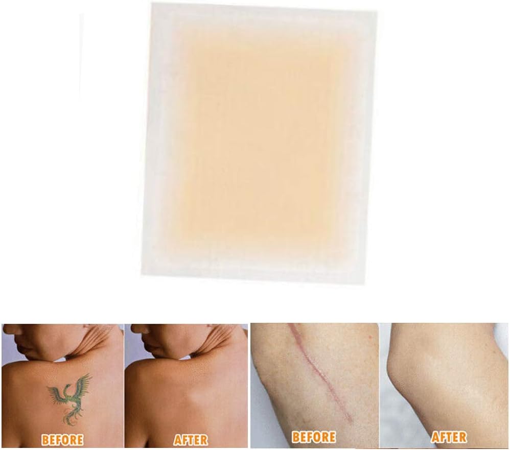 CHUANGE Tattoo & Flaw Covers Skin Shields Concealing Tapes Hiding Tattoo Flaw