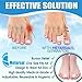 Metarsal Bunion Corrector Support Kit, Soft Gel Toe Separators & Bunion Cushions, Protector Shield & Pads Orthopedic Bunion Splint, Fast Relief Toe Drift Comfort Treatment One Size Fits Most Pack of 6