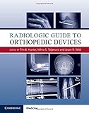 Radiologic Guide to Orthopedic Devices