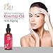 Best Organic Rosehip Oil for Face, Dry Skin, Hair & Stretch Marks - Gio Naturals Premium Grade is Pure Unrefined & Cold Pressed -Works Best On Eliminating Dark Spots, Wrinkles, Fine Lines & More!