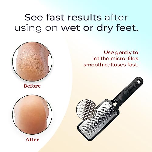 Microplane Colossal Foot File Scraper The Original Stainless Steel