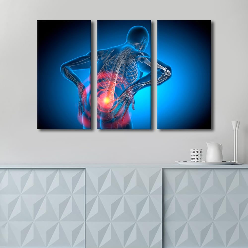Condition photo showing New/Like New for tumovo human anatomy wall art painting lower back pain bedroom living room wall decor spine x-ray fr