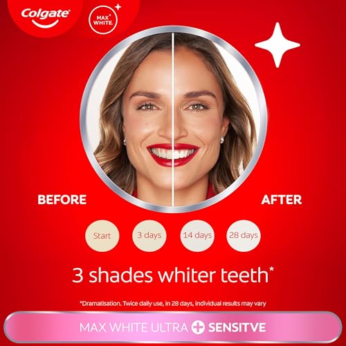 Colgate Max White Ultra + Sensitive Toothpaste 75ml | Clinically Proven 5x Whiter Teeth* and 24/7 Protection** for Sensitive Teeth