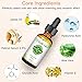 Retinol Serum for Face - Face Serum High Strength 2.5% With Hyaluronic Acid Serum for Anti-Aging & Wrinkle with Glycolic Acid, Aloe Vera for Eye Moisturize Skin Care Serum for Face