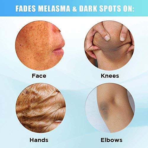 hydroquinone for dark knees